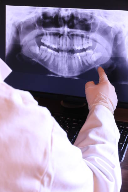 Best Emergency Dental Care for Broken or Chipped Teeth in Collierville, CA