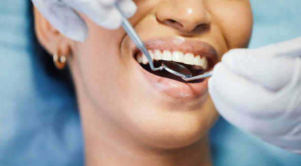 Best Emergency Dental Care for Broken or Chipped Teeth in Collierville, CA