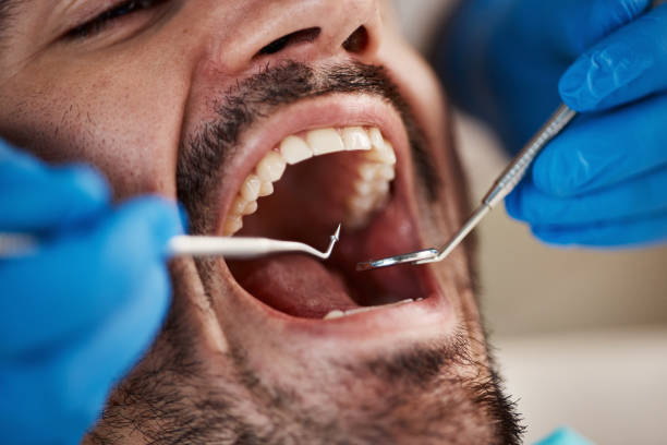 Best Pediatric Emergency Dentist in Collierville, CA